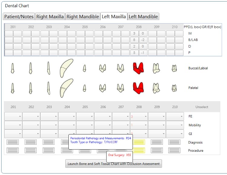 Dental Chart - Charting View